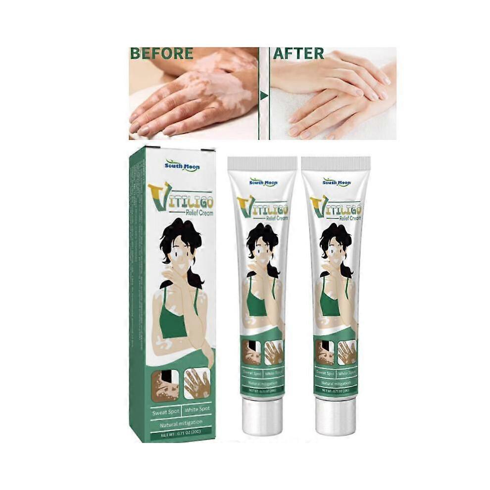 2 uds. Crema Reparadora de Piel para Vitíligo, Crema Tratamiento Vitíligo, Elimina Manchas Blancas en la Piel y Mejora la Pigmentación de la Piel
