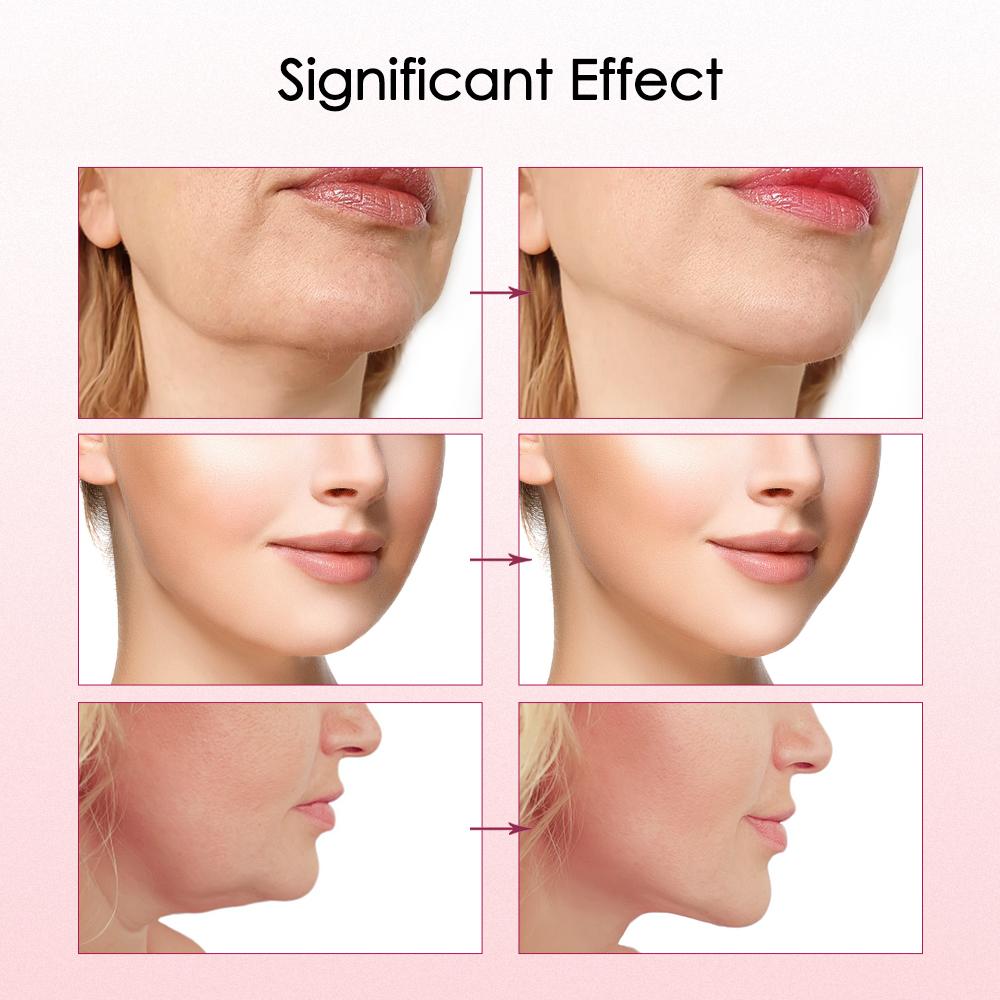 V-Line Face Slimming Lifting Device Electric Face Massager 8/5 Modes 15 Intensity Double Chin Lift Up Belt Beauty Instrument