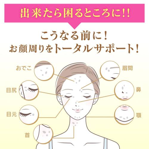 [Keshimin] Keshimin penetrating lotion, very moist main body [Contains vitamin C derivatives and V White C] [For the prevention of age spot
