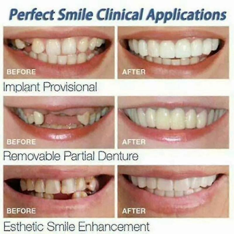 4 Pcs Snap On Smile Teeth Veneers Whitening Cosmetic Denture, Tooth Cover Set (hs)