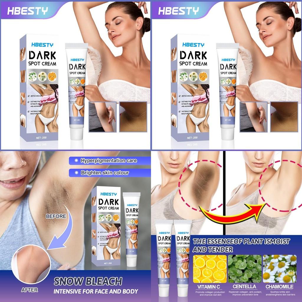 Hbesty Skin Brightening Cream For Underarm Thigh And Elbow Dark Spot Care