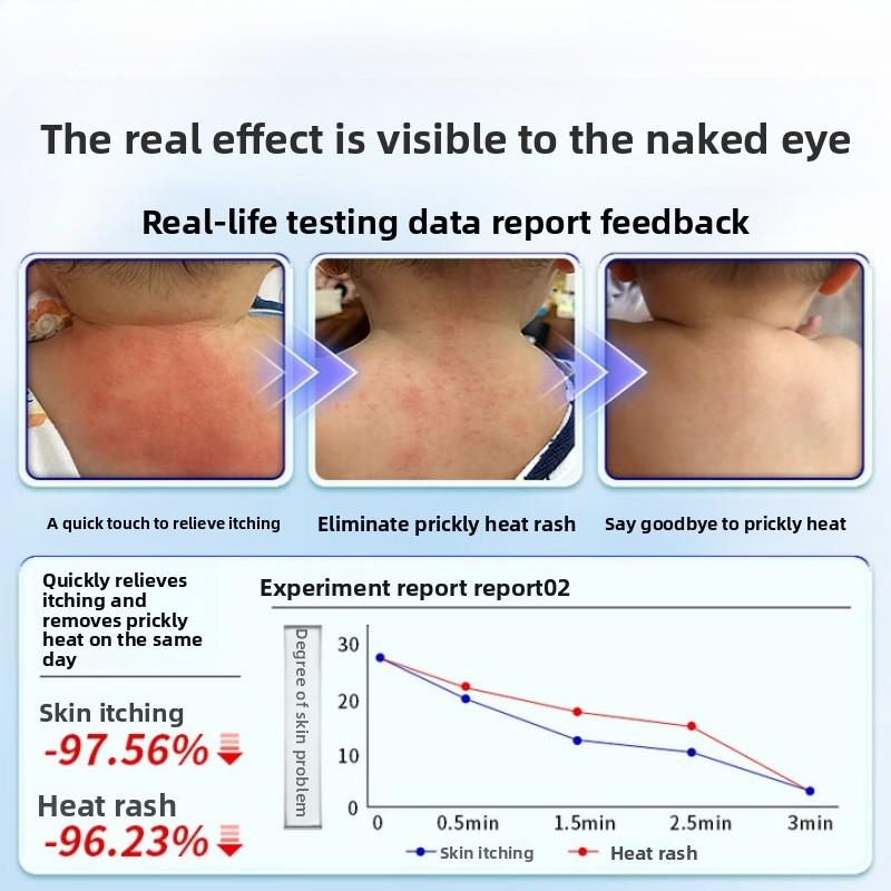 Itch Relief Fast! Anti-Itch Cream for Urticaria & Skin Allergies - Soothes Hives, Rashes On Body, 50g