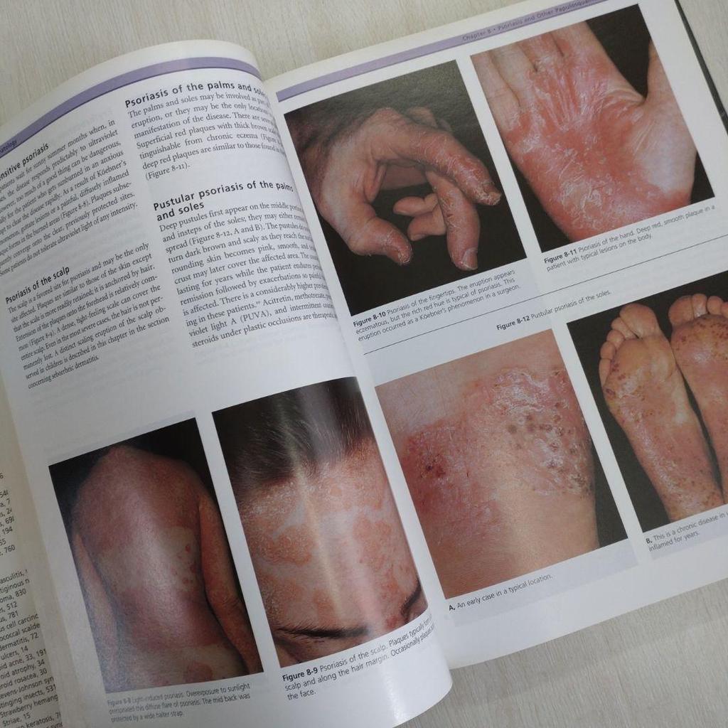 [USED] CLINICAL DERMATOLOGY HABIF Mosby Medical Materials