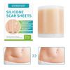 Silicone Gel Scar Patch: 1.5m Self-Adhesive, Waterproof, Sweatproof, Neutral Packaging