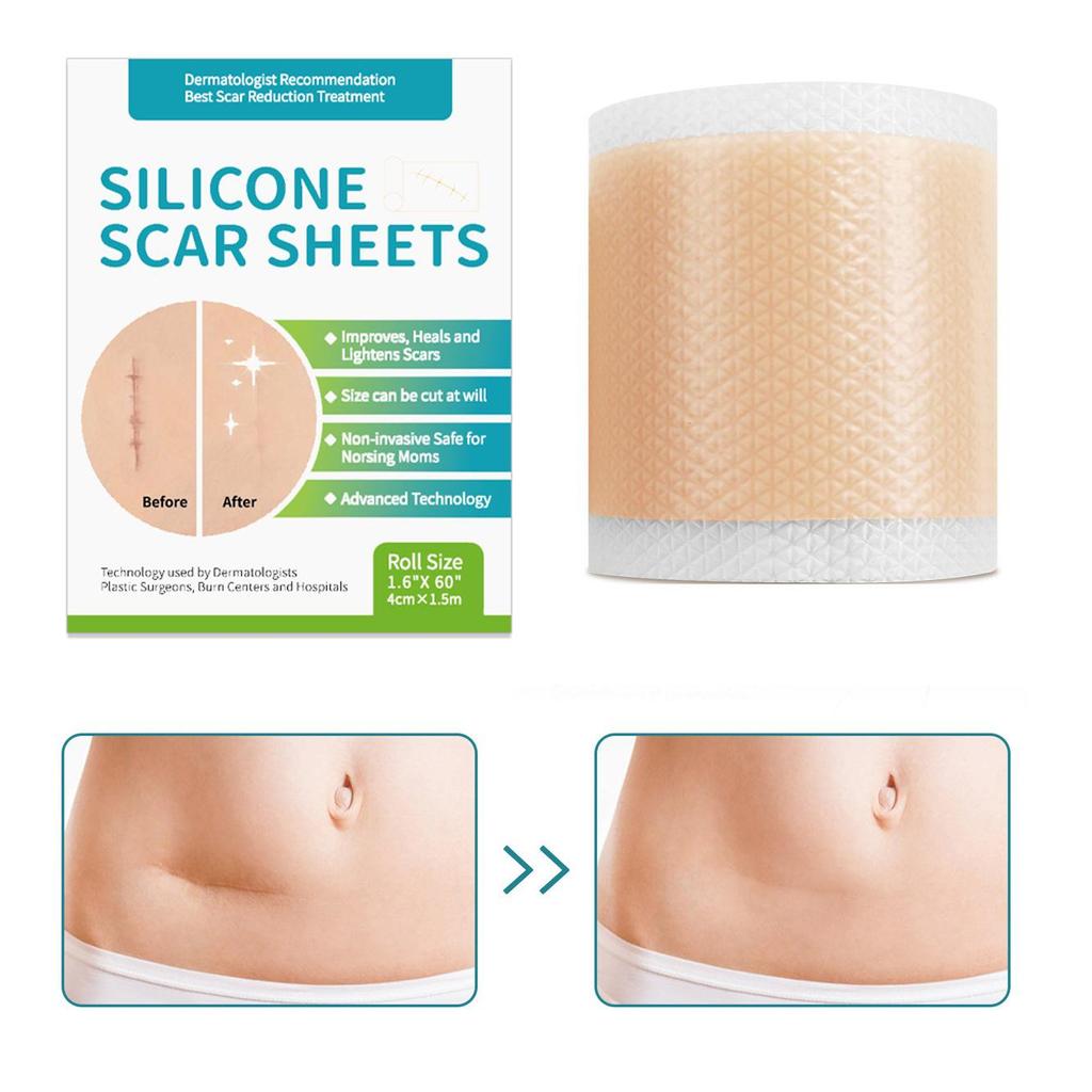 Silicone Gel Scar Patch: 1.5m Self-Adhesive, Waterproof, Sweatproof, Neutral Packaging