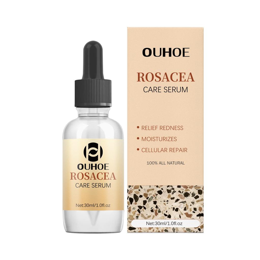 Soothing Repair Serum Redness Relief Hydrating Essence 30ml Face Care Sensitive Skin