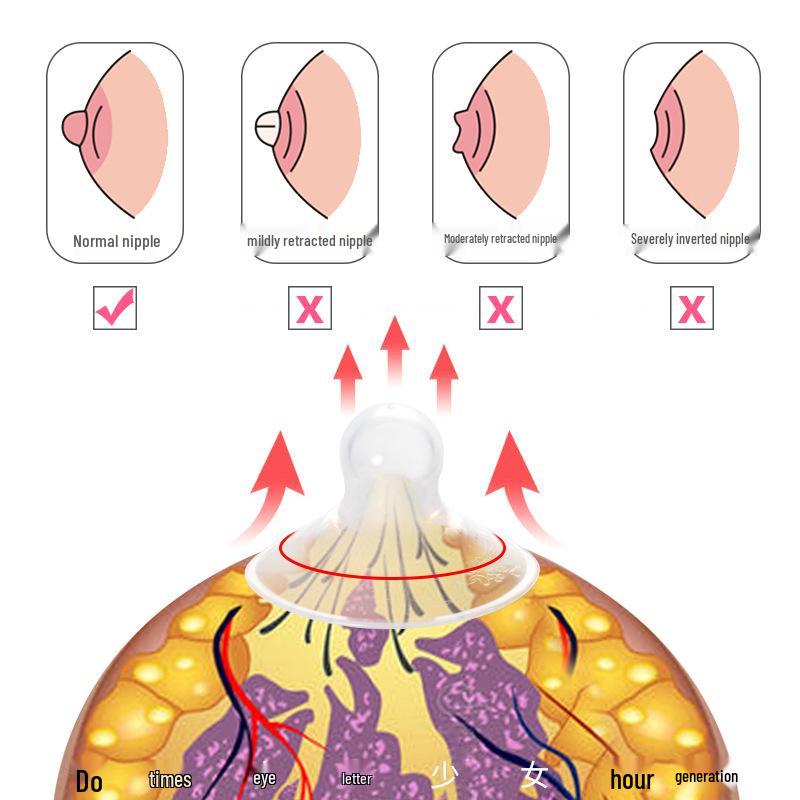Brustwarzenkorrektor für das Stillen: Invertierte, Kurze, Kleine, Flache Brustwarzenkorrektur und Erholung nach der Geburt