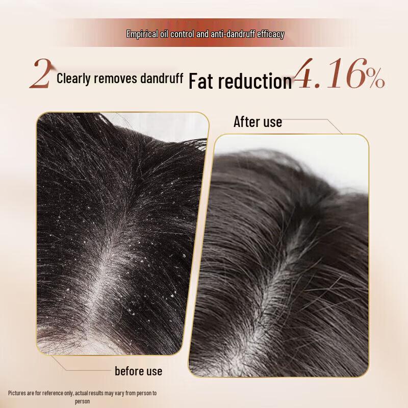 ZiYuan Tea Seed Oil Control Anti-Dandruff Shampoo