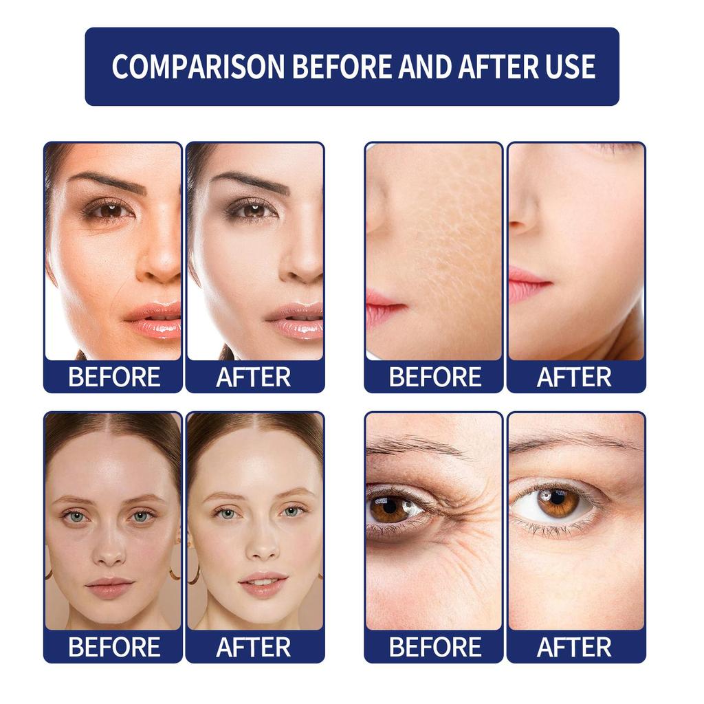 Jaysuing Eye Gel - Nourishing and Moisturizing, Firms Skin, Reduces Fine Lines and Dark Spots, Brightens Skin, Suitable for Full Face, 35g