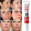 Powerful Spot-Removing Whiten Cream Brighten Skin Fast Eliminates Melanin Pigmentation Melasma Dark Spots