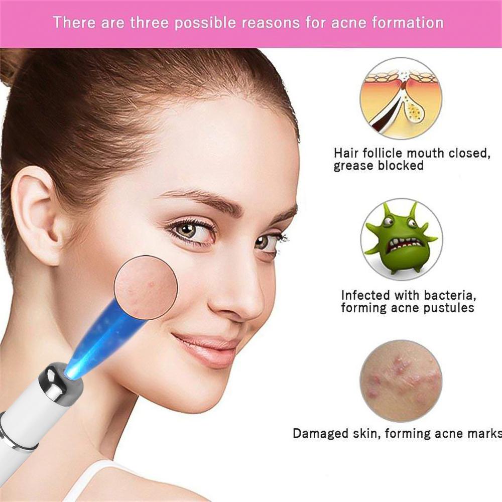 Facial Beauty Device Eye Massager Blue Light Black Eye Circles Facial Care Tool Lightening Texture Maintaining Eye Bags