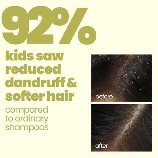 TuCo Kids Anti-Dandruff Shampoo With Wintergreen, Mint & Activated Charcoal |Ph5.5, Vegan & Tear Free | Ages 2-5, 4-10, 10-15 Years | 200Ml