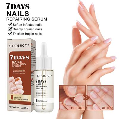 20ml 7 Days Nail Growth And Strengthening , Nail Growth And Strength , 7 Days Nails Repairing , Nail Growth & Strengthening Oil