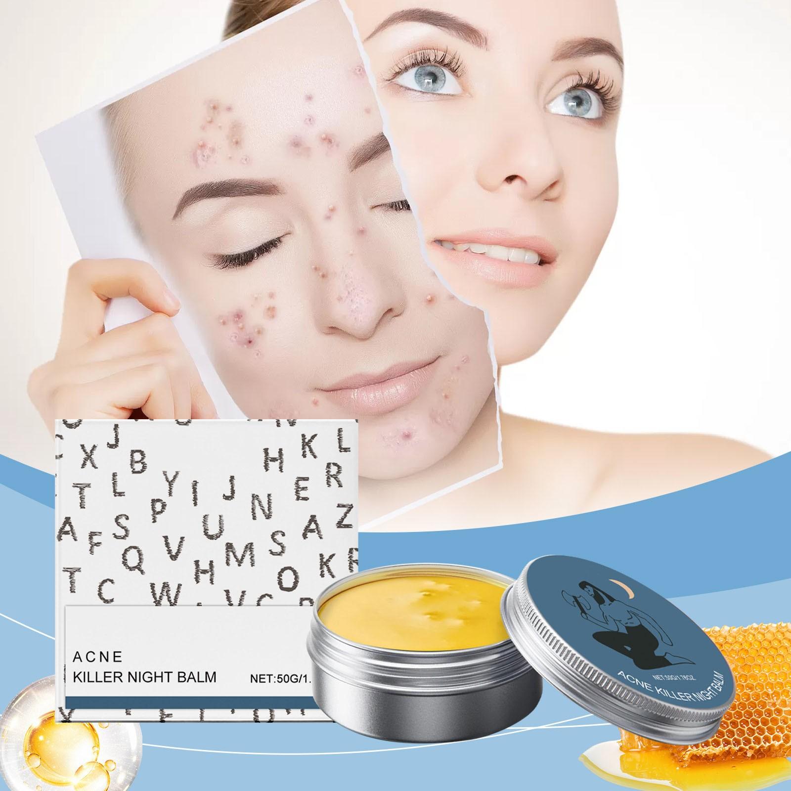 

Увлажняющий крем от прыщей, нежное и сбалансированное масло для кожи, подходит для кожи, склонной к прыщам, мягкий и нежный крем для ухода за кожей One Size