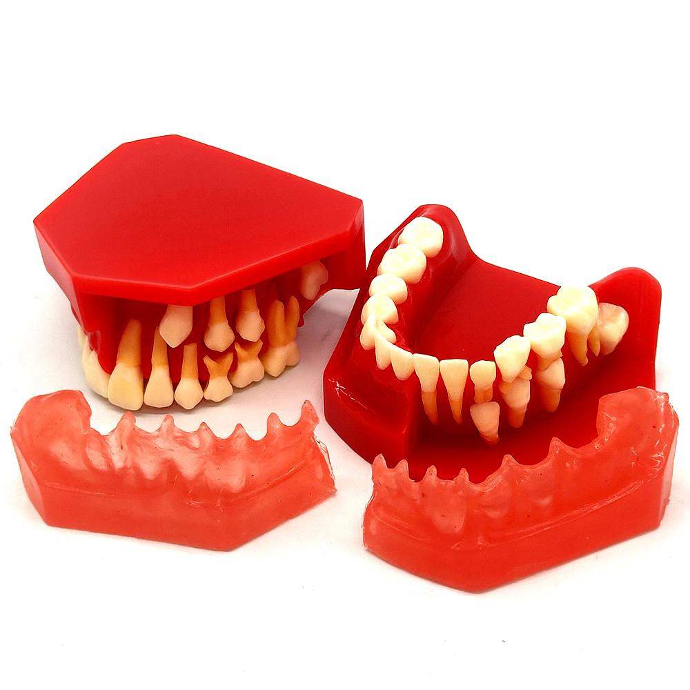 Dental Kinder Milchzähne Modell Ersatz Modell Permanente Zähne Alternative Display Abnehmbare Demonstration für Lehre Zahnarzt Modelle