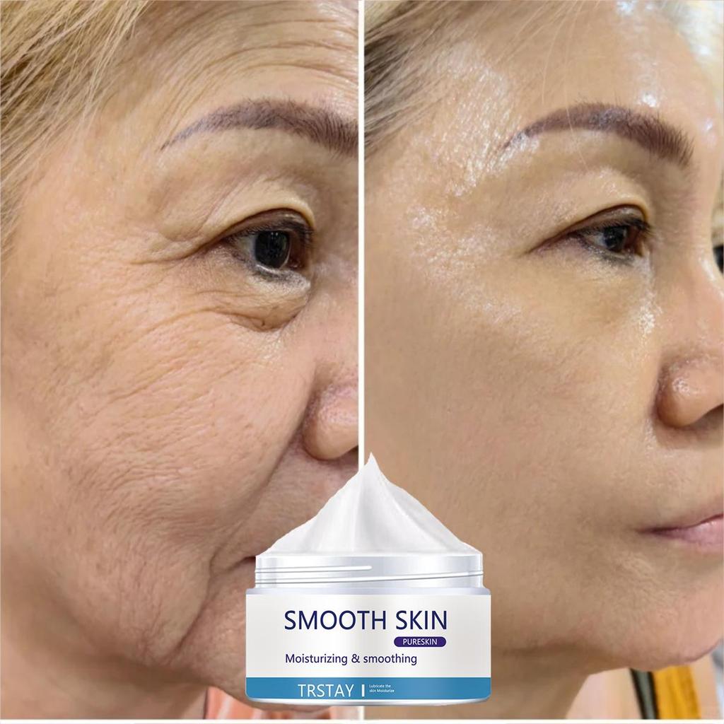 Whitening and Acne Removing essence Cream, brightening facial skin, anti-oxidation and anti-aging, moisturizing cream