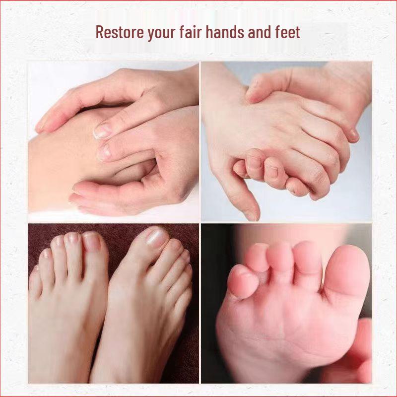 Genuine Yunnan Fungus King Heel & Hand Anti-Cracking Cream for Dry, Rough Skin