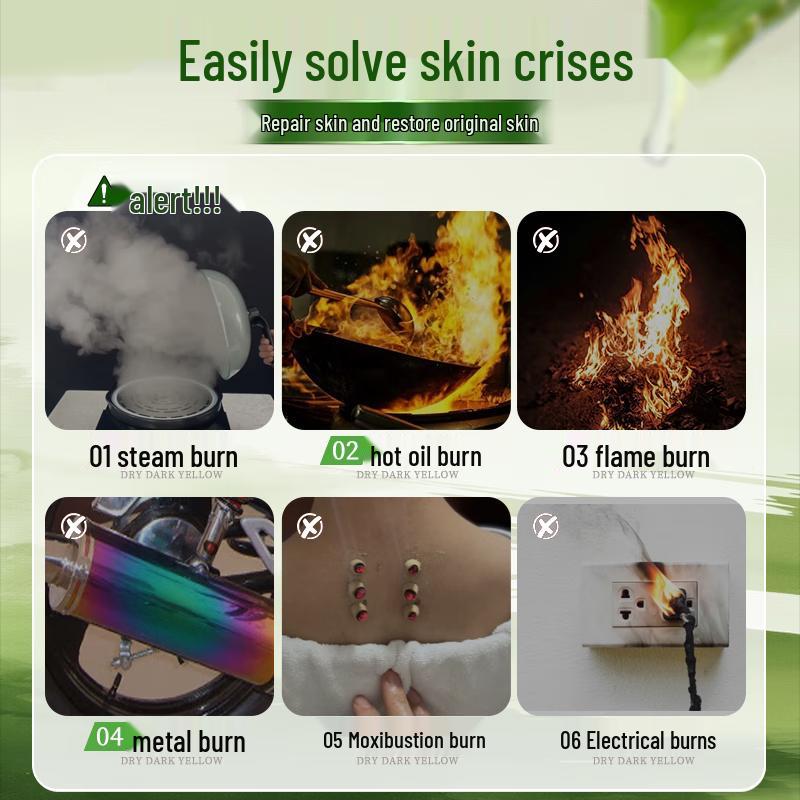 Мазь Qianji от ожогов и обморожений с барсучьим жиром