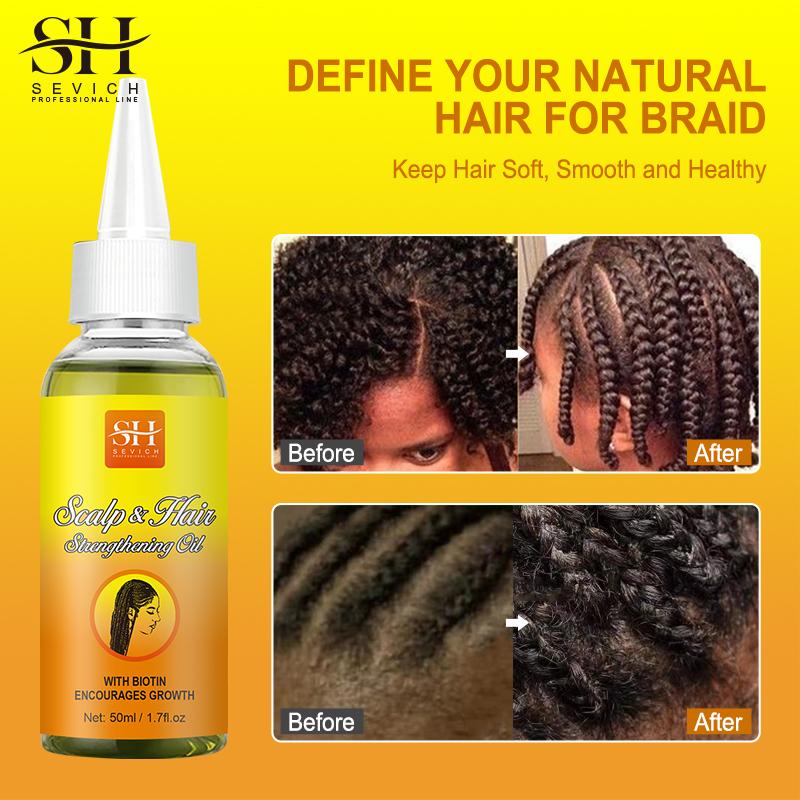 

African Anti-itch Hair Growth Braid Oil Sevich Moisturizing Anti Hair Loss Hair Styling Gel Traction Alopecia Treatment Hair Care