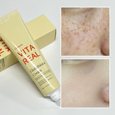 Glutationa creme para sardas pigmentação manchas manchas da idade sardas hidratação regeneração hidratante creme clareador, 50ml, 1 peça