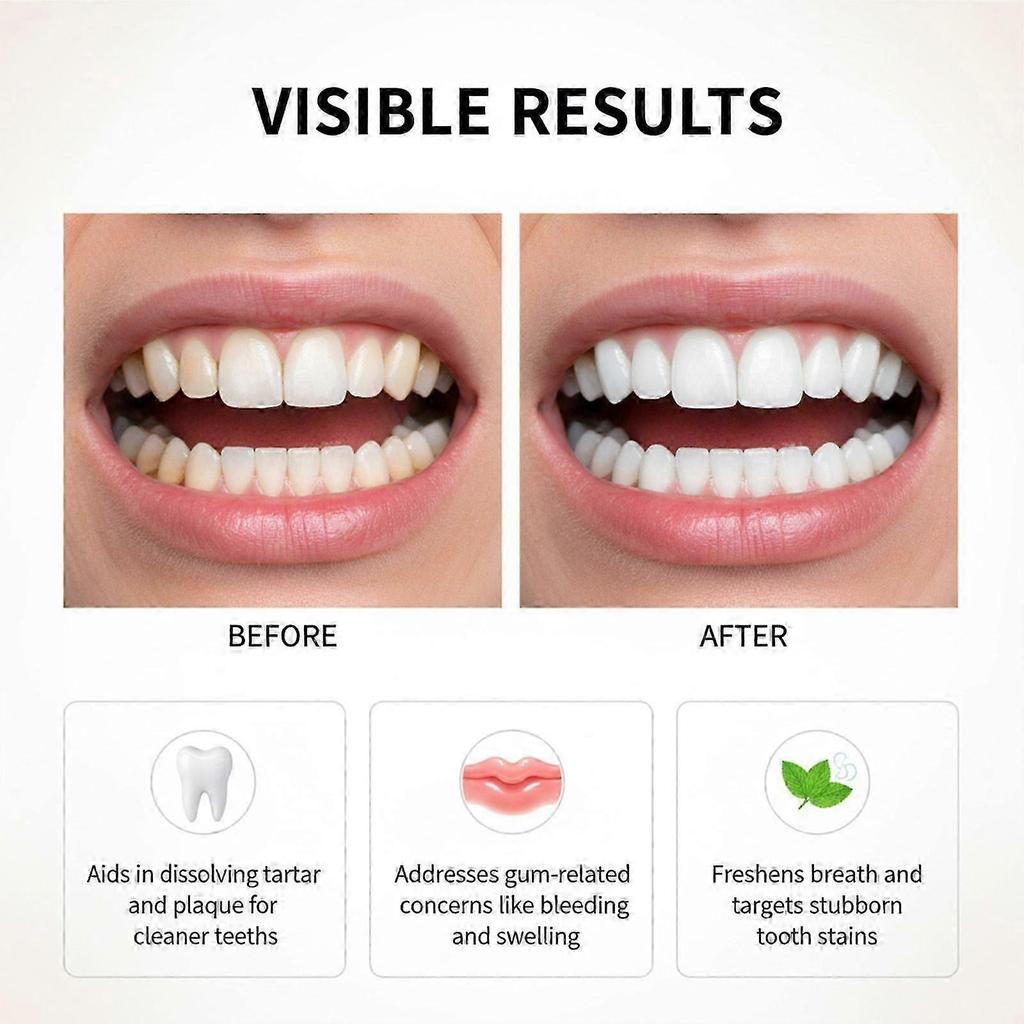 Feimuko Bee Venom Mouthwash for Daily Oral Care