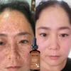 5ML/15ML/30ML/50ML/TRSTAY Effective Whitening Freckle Cream Remove Dark Spot Face Cream Removal  Melasma Lighten Brighten Smooth Skin Care