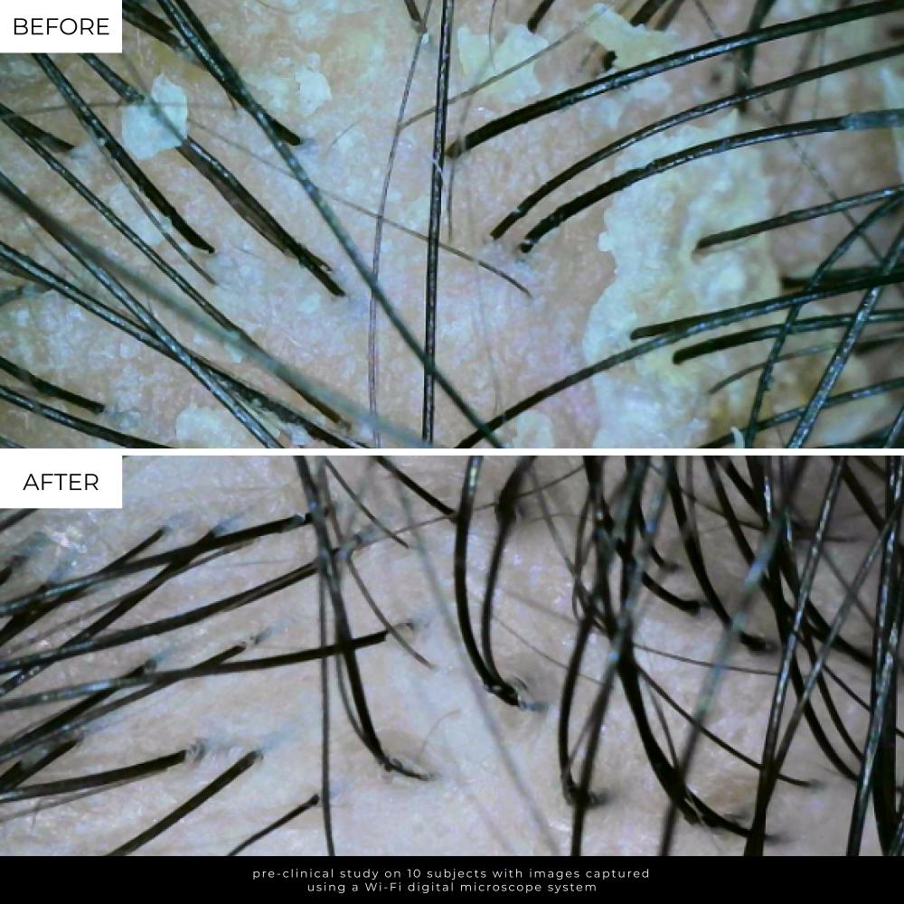 Lolavie Peeling-Detox-Kopfhaut-Shampoo, 180 ml