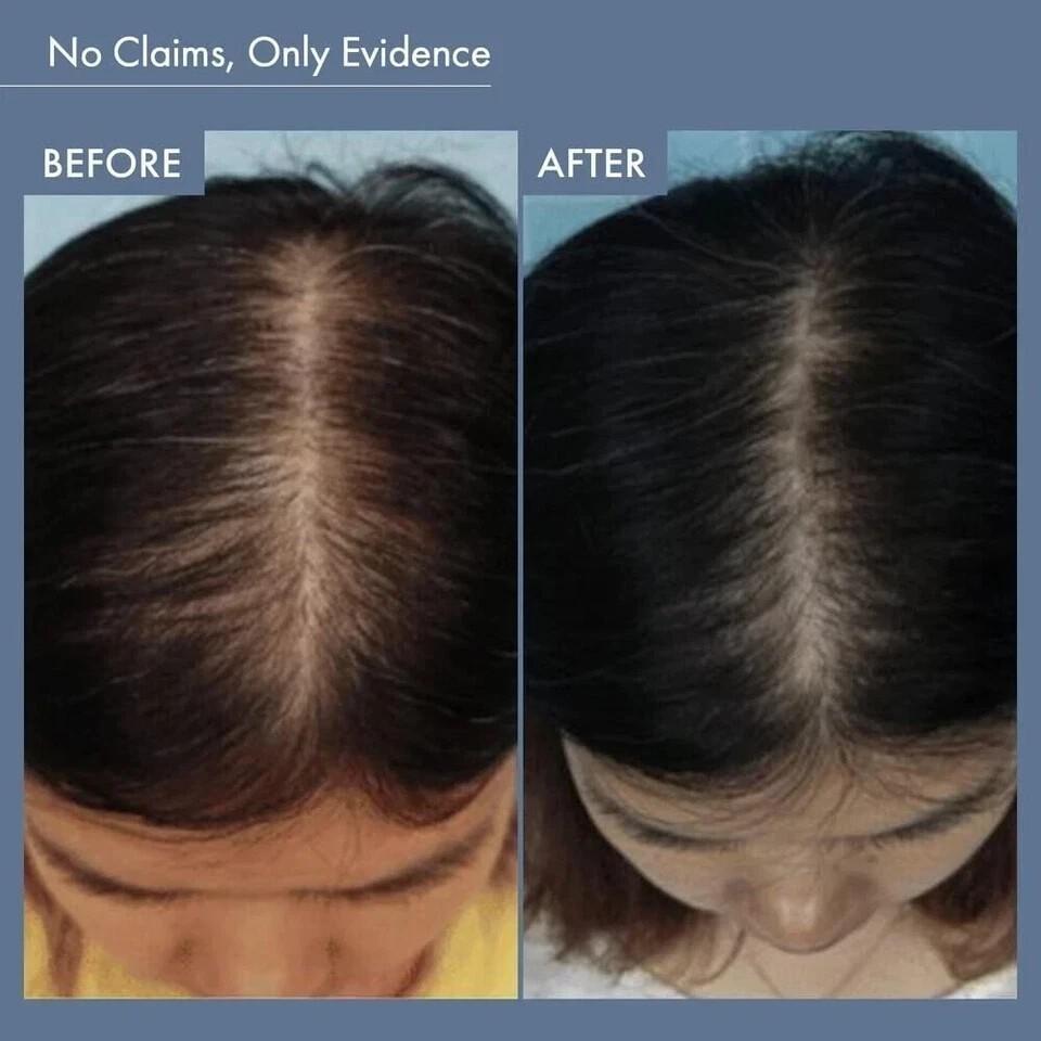 ThriveCo Rosemary Hair Shampoo For Voluminous Hair - (250 Ml)