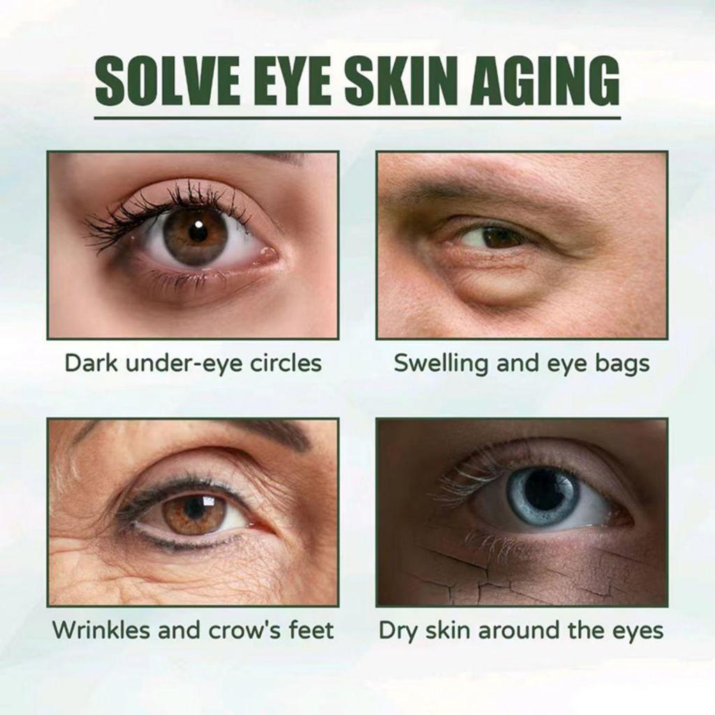 Retinol Eye Cream Tightens And Brightens The Delicate Skin Around The Eyes