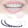Temporary Tooth Decoration Practice Prop,Supplies Metal Bracket for Students