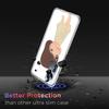 Cute Nara Yoshitomo Art Phone Case For Redmi Note 13 Pro Plus 14 Pro+ 12S 12 11S 11T 11E 11 10S 10 9S 9 Xiaomi Capa TPU