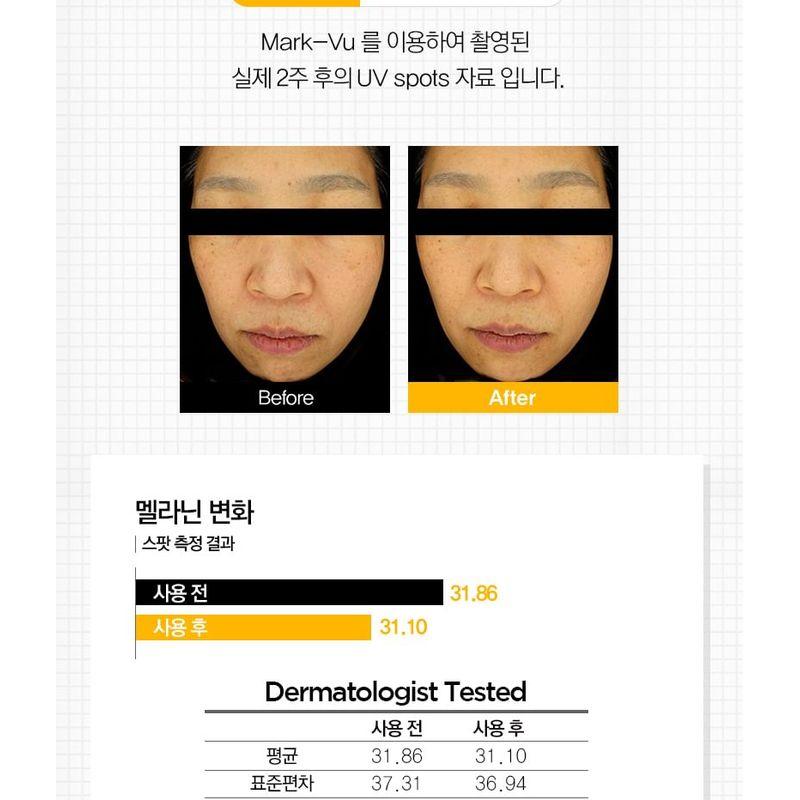 TOSOWOONG - 8 Days Spot Cream