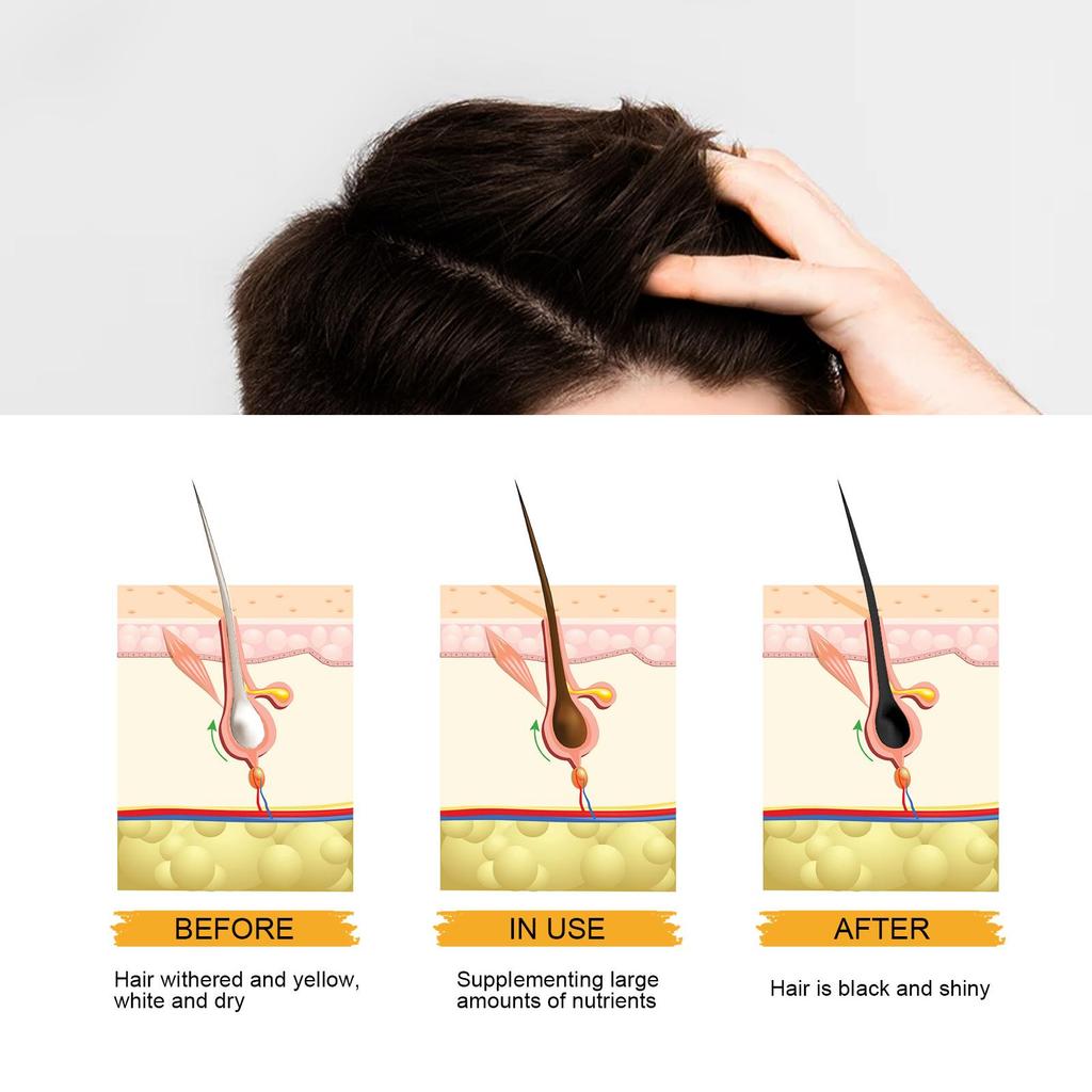 Polygonum Multiflorum Black Hair Soap Darkening Shampoo Bar Repair Gray White Color Dye Face Hair Body Shampoo For Man Women
