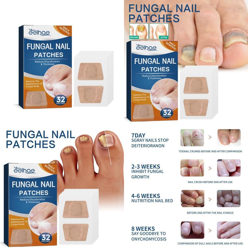 Eelhoe Zehennagel Reparatur-Pflaster für Pilznägel Verdickte Nagelbehandlung 32 Stück