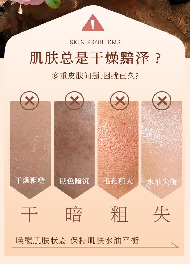 Rose Essence Treatment Water