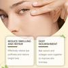Ouhoe Bee Venom Eye Serum Gentle Moisturizing Nourishing Daily Skin Care Essence 30ml For Premium Beauty Routine