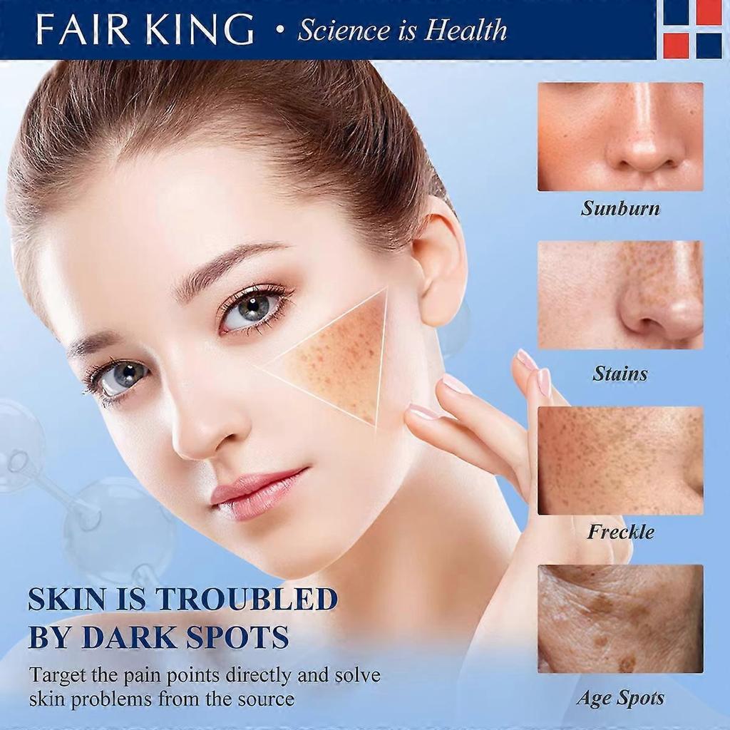 Whitening Cream for Face, Dark Spot Corrector, Fades Melasma & Sun Spots, Brightens Dull Skin, Anti-Pigmentation Serum, 30ml
