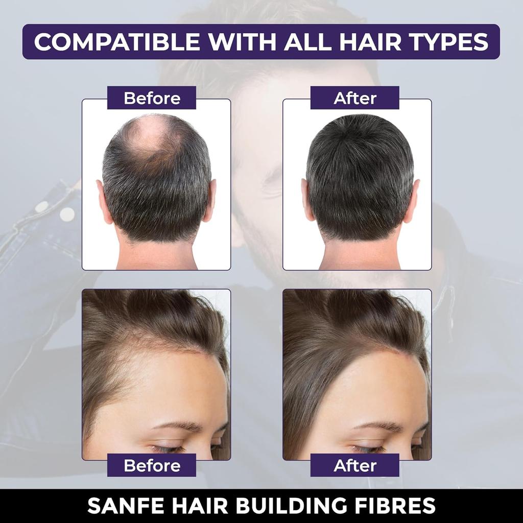 Instant Bald Spot Covering Fibers (22g) | For Fine and Thinning Hair for an Instantly Thicker & Fuller Look - Best Value & Superior Formula | Black