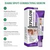 Freckle Whitening Cream Melasma Dark Spots Pigmentation Removal Product Fade Stain Melanin Fast Repair Brighten Korean Skin Car
