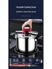 304 Stainless Steel Household Pressure Cooker, Explosion-Proof, Compatible with Induction & Gas Stoves, 4L & 6L, Serves 3-4 People