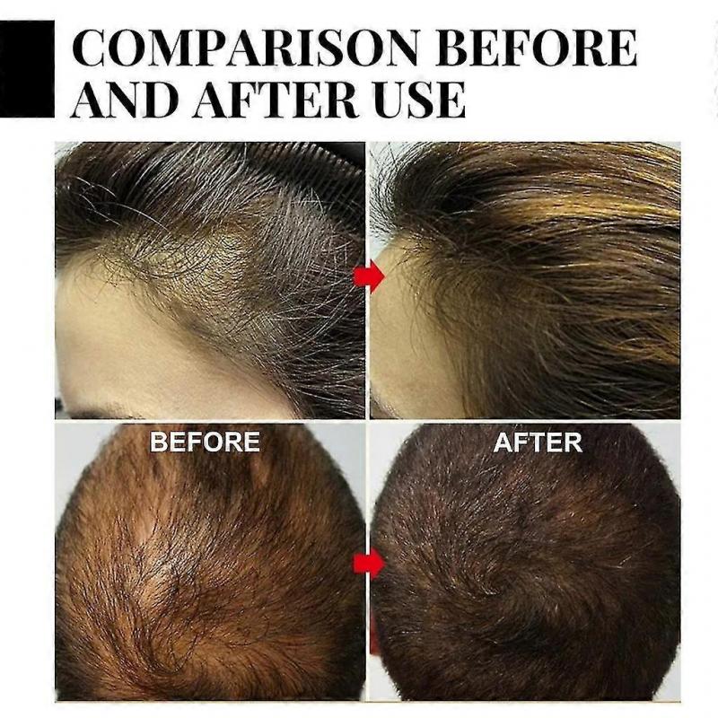30ml Batana Oil Hair Spray for Deep Nourishment, Strengthens Hair Roots, Repairs Dry & Frizzy Hair, Home Use Hair Treatment Spray