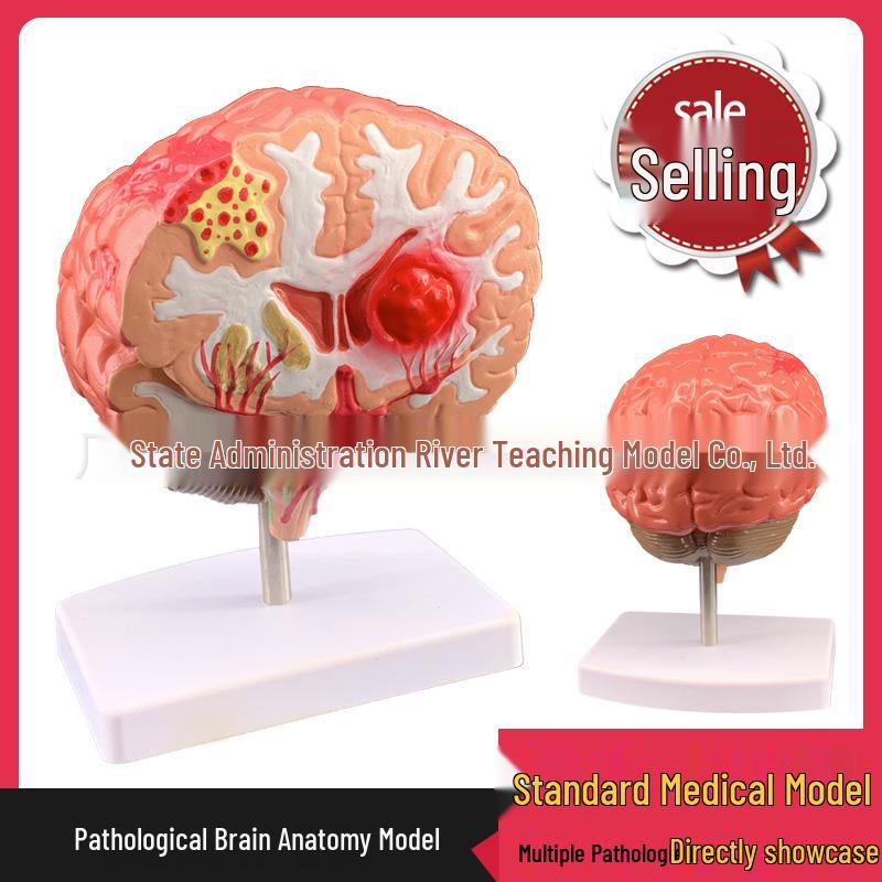 Simulated Human Brain Disease and Pathology Model 11x11x19 cm
