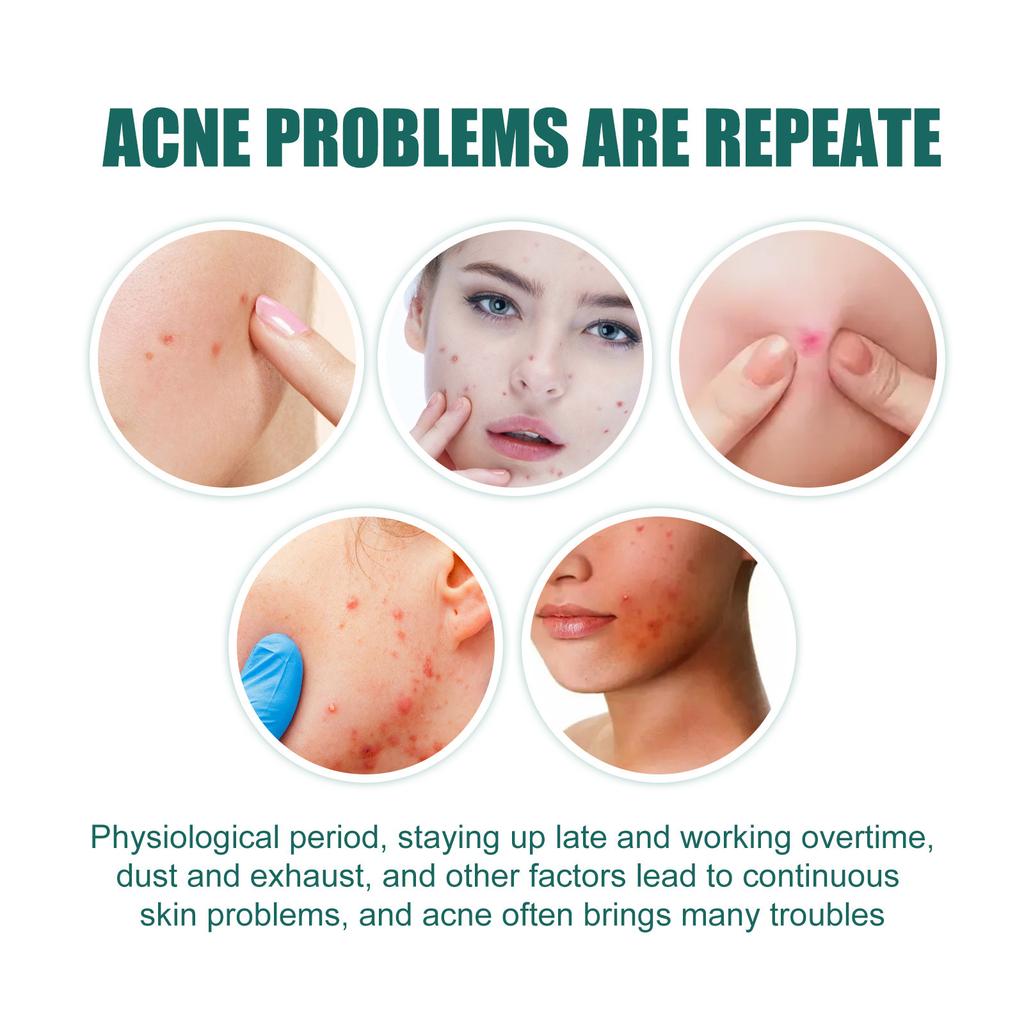 EELHOE 114 Patches Waterproof Acne Pimple Patch Stickers Acne Treatment Pimple Remover Tool Invisible Breathable Acne Patch Skin Care