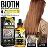 3x Vitamin B7 Hair Essential Oil Treatment Preventing Loss Restorer Essential Oil Biotin Hair Growth Oil 30ml