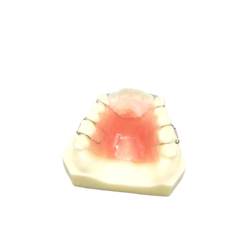 Maxillary Partial Denture Demonstration Model - White Tooth for Doctor-Patient Communication (Free Shipping)