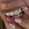 Mirco Bling Teeth Zircon Prong Butterfly Shape Gold-plated Braces Hip-hop Rap Single Grills for Teeth