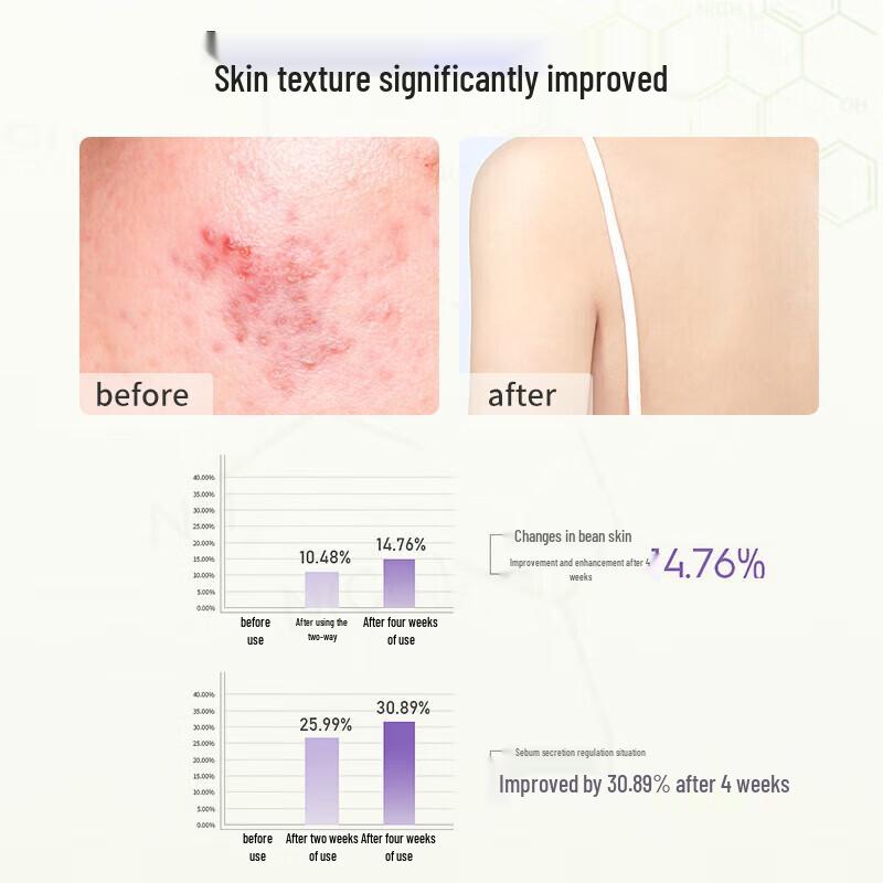 Senzhilu Oil Control Acne Body Wash