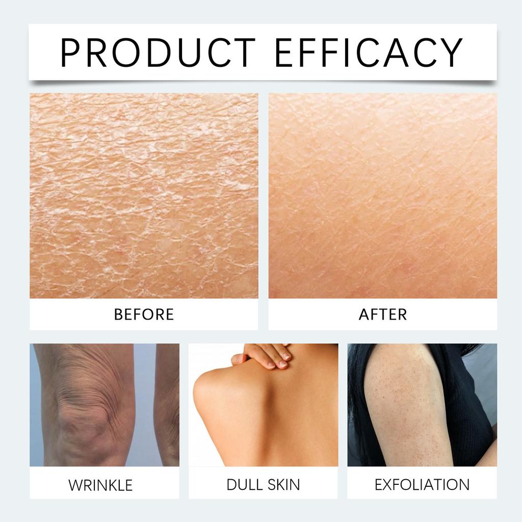 Moisturizing Skin Ceramide Cream Deeply Hydrates The Skin, Protects The Skin Barrier And Improves Skin Texture.
