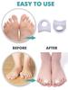 2Pcs Silicone Toes Separator Bunion Bone Ectropion Adjuster Toes Outer Appliance Foot Care Tool Hallux Valgus Corrector