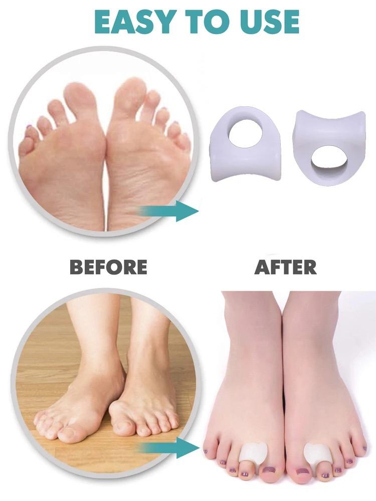 2Pcs Silicone Toes Separator Bunion Bone Ectropion Adjuster Toes Outer Appliance Foot Care Tool Hallux Valgus Corrector